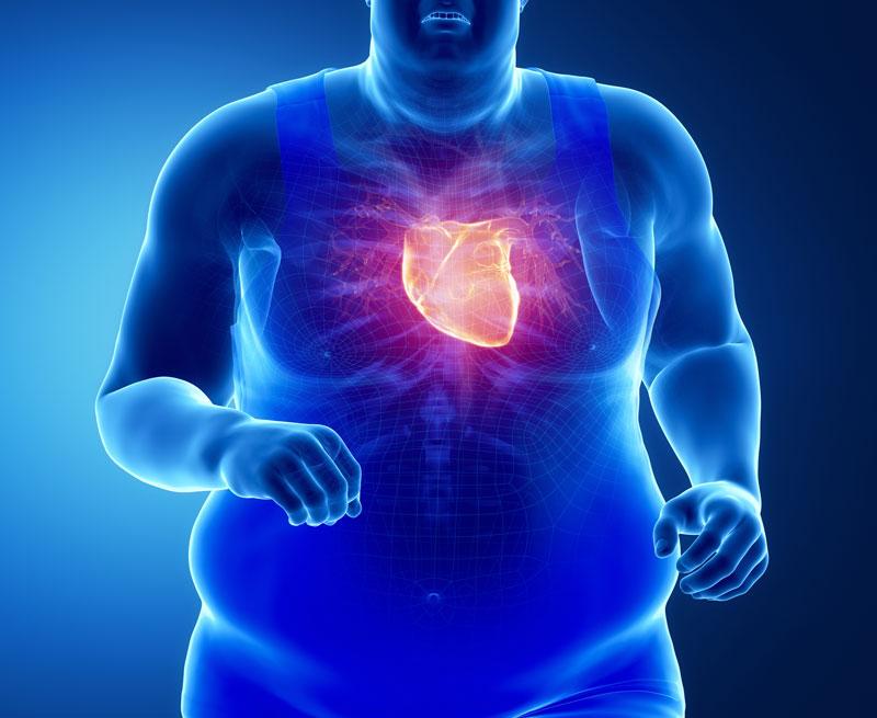 người thừa cân béo phì có nguy cơ mắc bệnh tim mạch khá cao